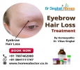Benefits of Eyebrow Hair Loss Treatment in Homeopathy